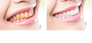 Dental services
